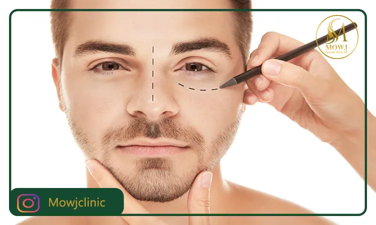 جراحی بلفاروپلاستی