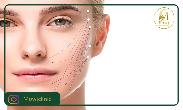 عمل اندولیفت چیست؟