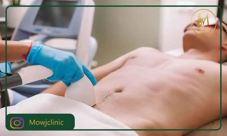 عوارض لیزر ناحیه تناسلی مردان