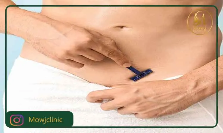 اقدامات قبل از لیزر ناحیه تناسلی مردان