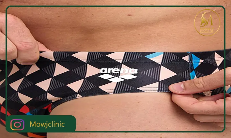 لیزر خط مایو آقایان