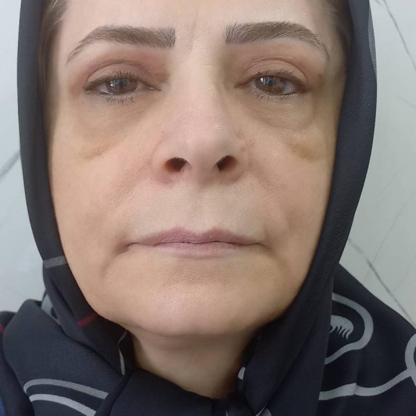 ۲۰۲۴۰۸۰۷_۱۰۴۸۲۵ (1)