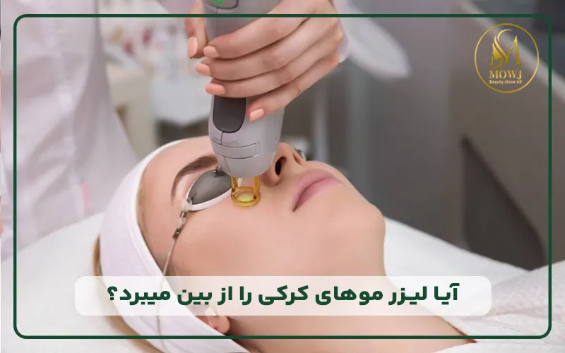 آیا لیزر موهای کرکی را از بین میبرد؟