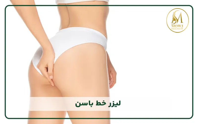 لیزر خط باسن